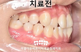 수술전