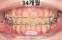 수술후