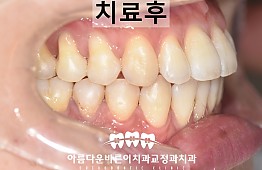 수술후