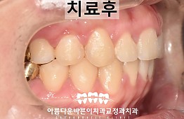 수술후