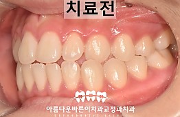 수술전