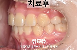수술후