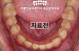 수술전