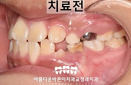 수술전