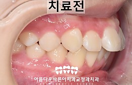 수술전