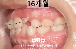 수술후