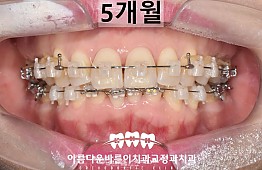 수술후