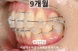 수술후