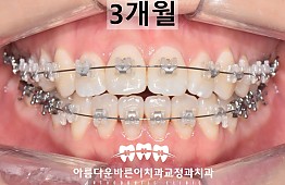 수술후