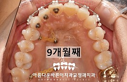 수술후