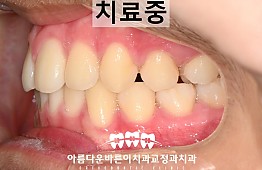 수술후