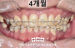 수술후