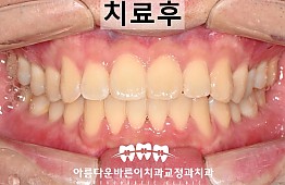수술후