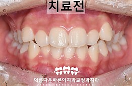 수술전