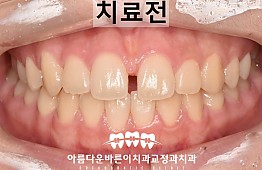 수술전