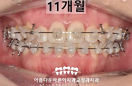 수술후
