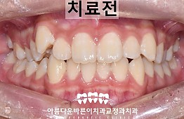 수술전