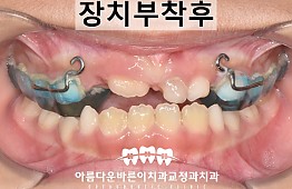 수술후