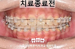 수술후