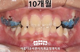 수술후