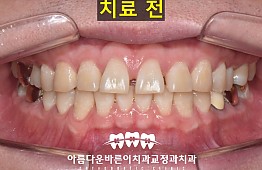 수술전