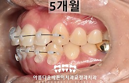 수술후