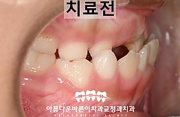 수술전