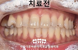 수술전