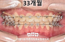 수술후