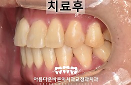 수술후