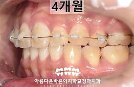 수술후