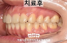 수술후