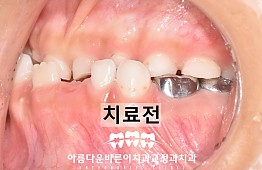 수술전