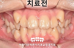 수술전