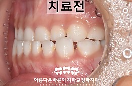 수술전