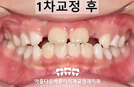 수술후
