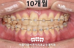 수술후