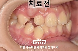 수술전