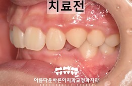 수술전