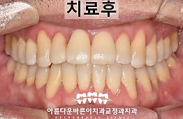 수술후