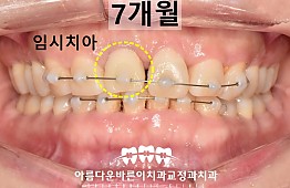 수술후