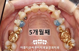 수술후