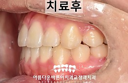수술후