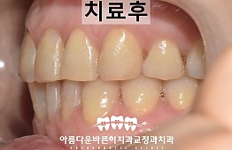 수술후