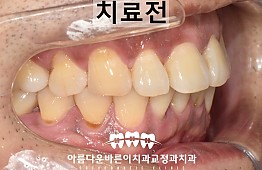 수술전