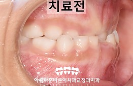 수술전