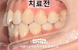 수술전