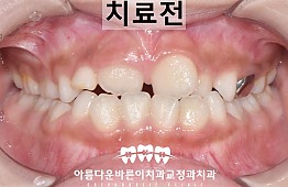 수술전