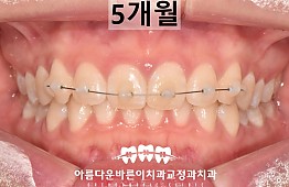 수술후