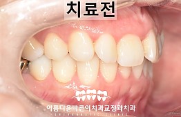 수술전